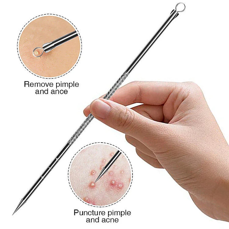 Professional Blackhead Remover Tweezers 4-Piece Set