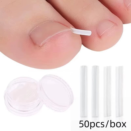 50Pcs Ingrown Toenail Correction Tool Ingrown Toe Nail Treatment Elastic Patch Sticker Straightening Clip Brace Pedicure Tool